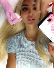 Cute little teen blonde getting her lips injected with silicone